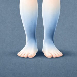 Œdème des membres inférieurs